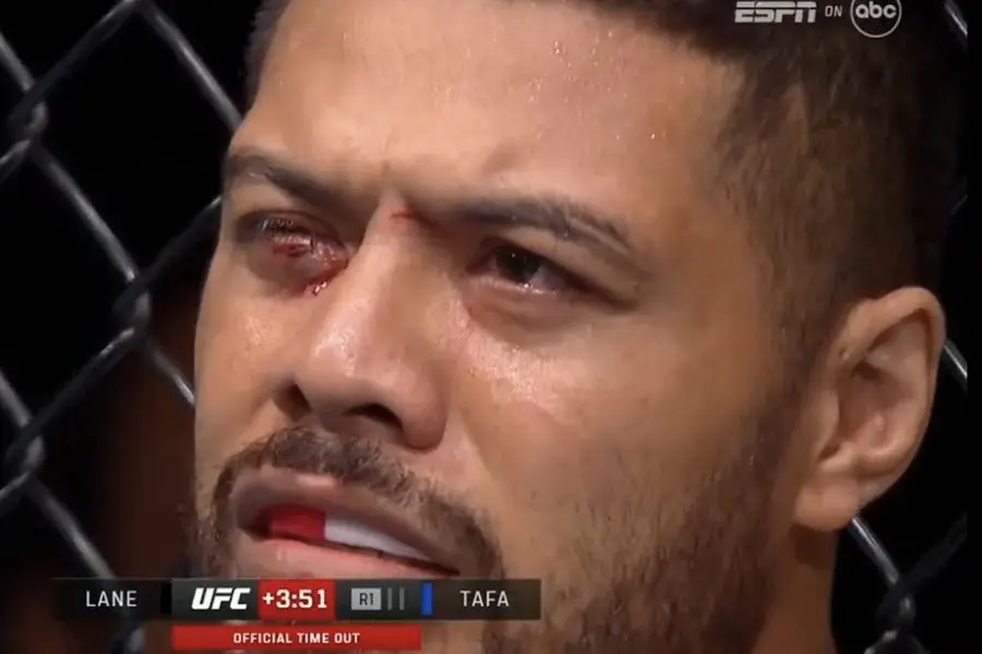 Justin Tafa UFC injury update: eyes cleared of major damage